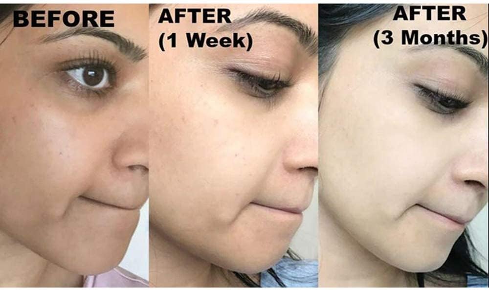 Kojiesan Skin Lightening Soap Classic - For a Lighter and Even Tone Skin - Fights Dark Spots, Scars and Age Spots - Zero Pigment Light - 135 g