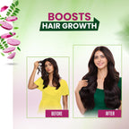 Emami Kesh King Ayurvedic Onion Oil- Complete Solution For Hair Related Problems- Protecting And Nourishing The Hair-100 ML