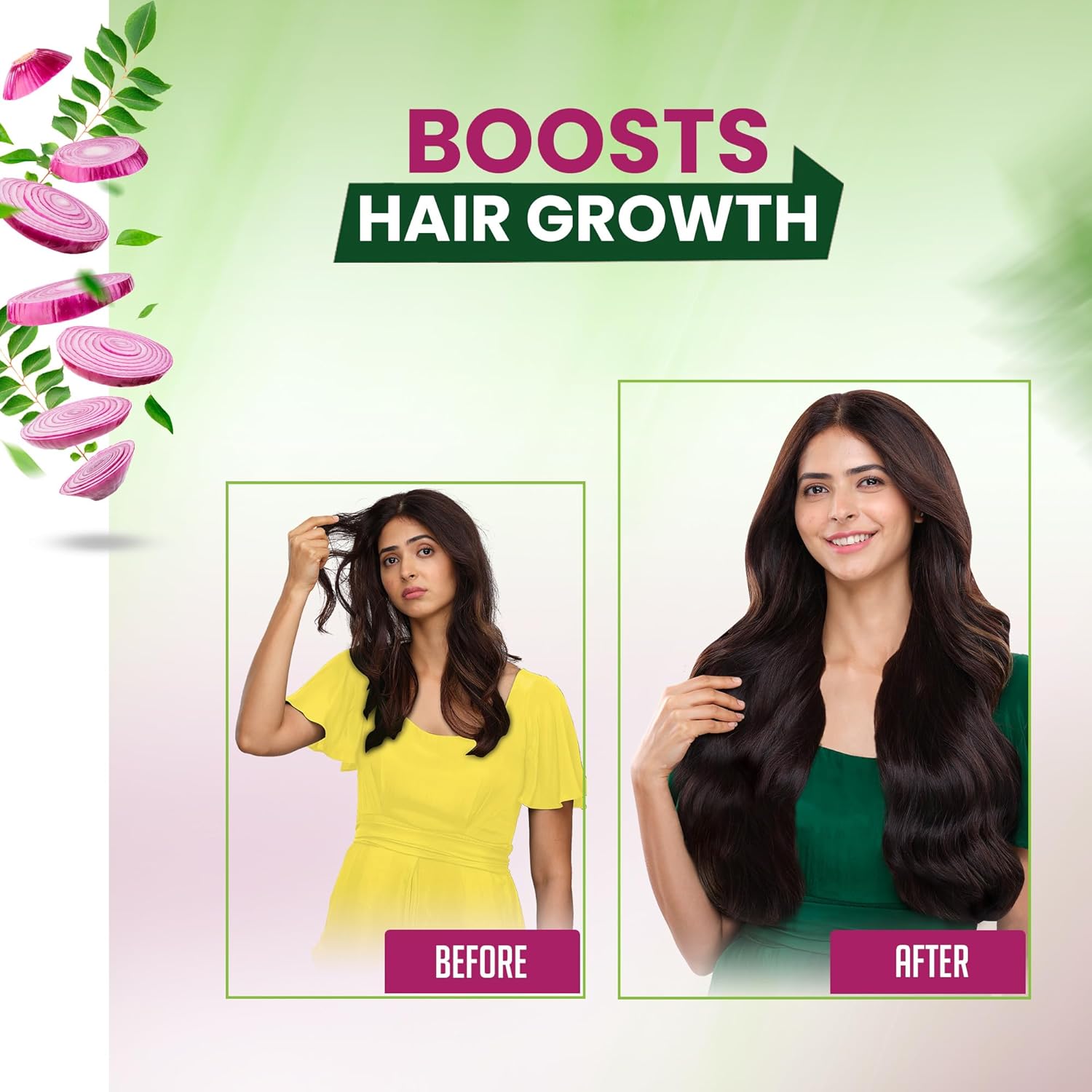 Emami Kesh King Ayurvedic Onion Oil- Complete Solution For Hair Related Problems- Protecting And Nourishing The Hair-100 ML