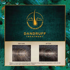 Indulekha Svetakutaja Oil  - Dandruff Treatment - Enriched By Amla Neem & Brahmi - 100 ml